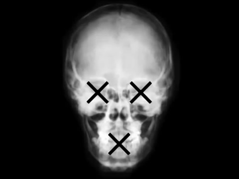 Рис. 98. 454 кадр по счёту, находится на 00:00:15 секунде.